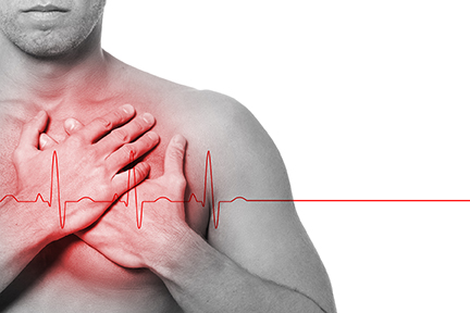 Cardiovascular Disease Image